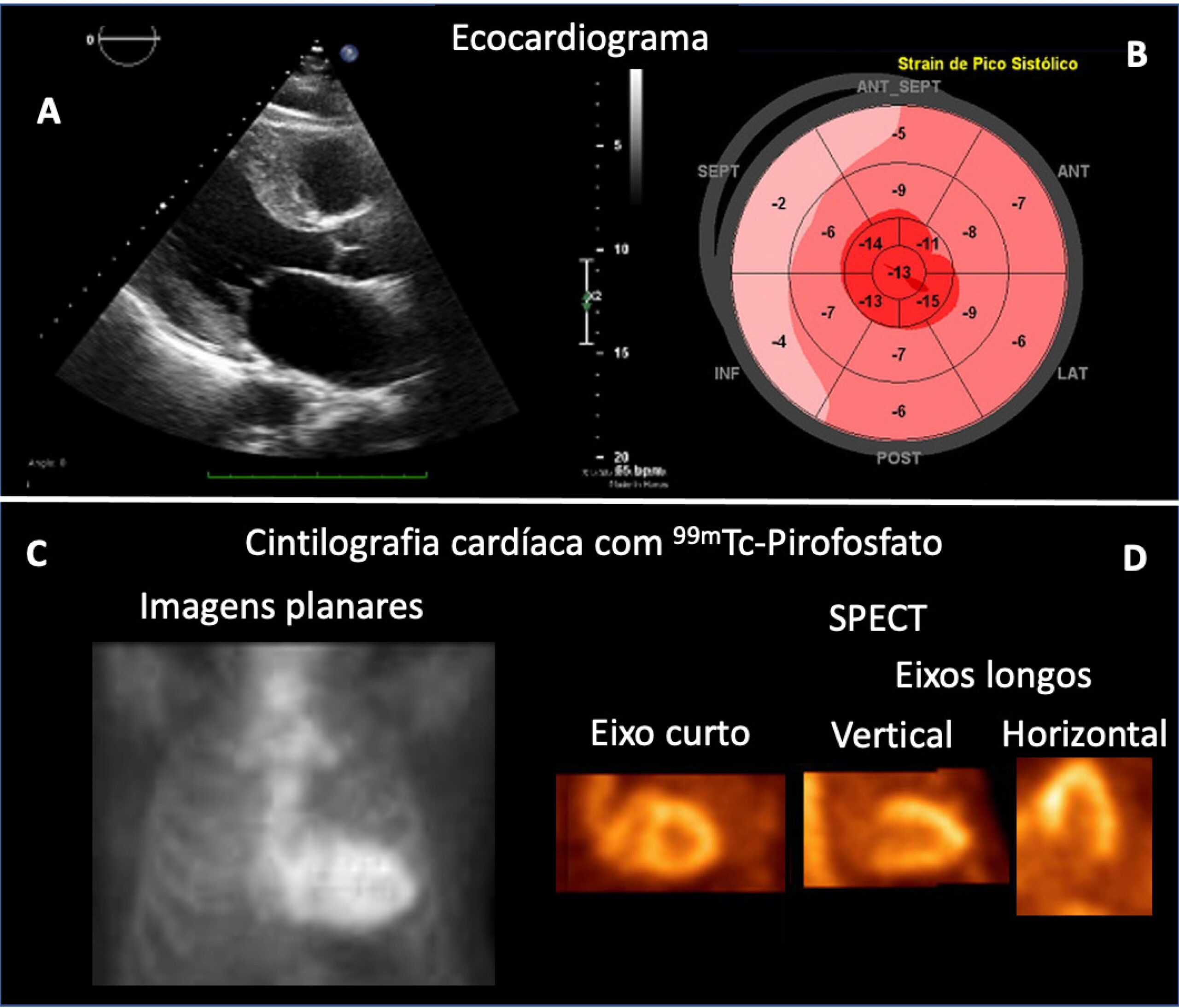 Figura 1