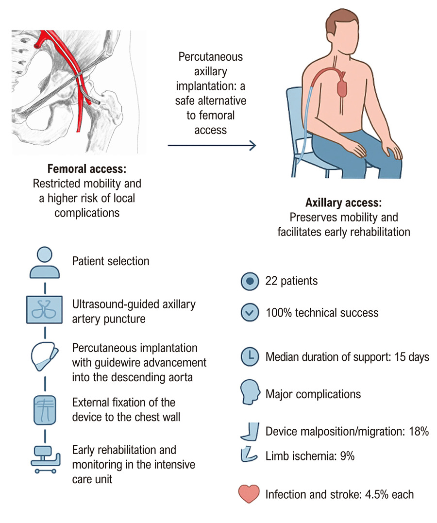 Percutaneous Axillary Intra-Aortic Balloon Pump Implantation in Patients Hospitalized with Heart Failure: Initial Brazilian Experience