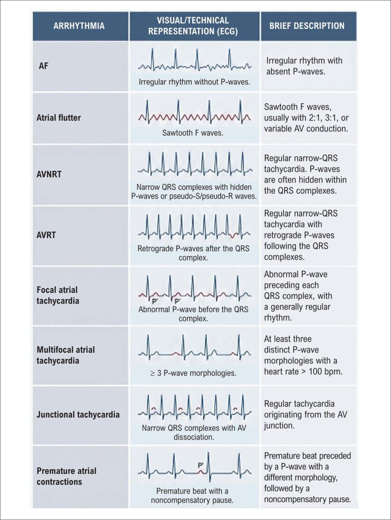 Figure 9.3