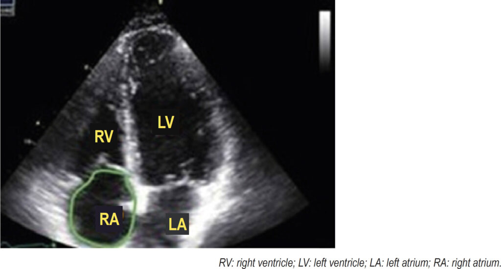 Figure 4