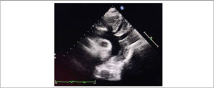 Figura 3