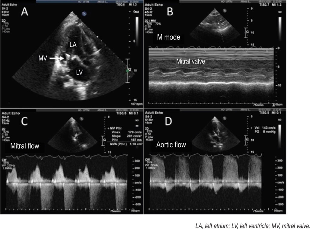 Figure 2