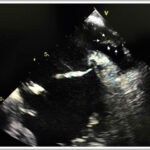 Figura 1