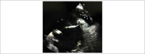 Figura 1
