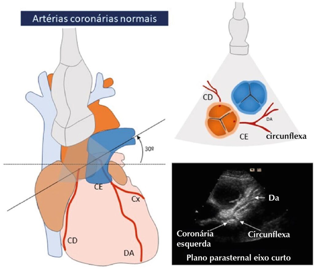 Figura 4