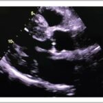 Figura 1