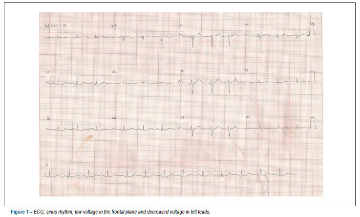 Case 1/2013: 69-year-old male patient with sudden back and lower right limb pain and shock