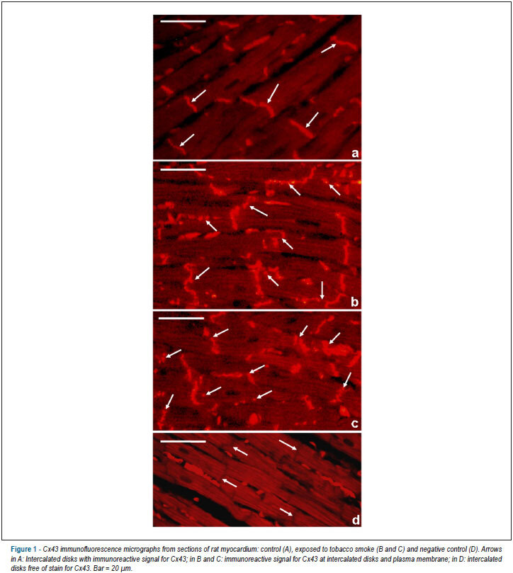 Smoking is associated with remodeling of gap junction in the rat heart: smoker's paradox explanation?