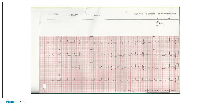 Case 2: sudden death after coronary artery bypass surgery in a 49-year-old female, diabetic, dyslipidemic, hypertensive, obese patient