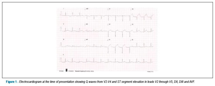 Stent Thrombosis eight years past drug-eluting stent placement: a case report