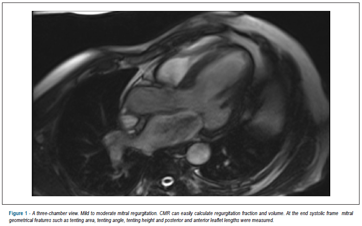 Cardiovascular magnetic resonance imaging-derived mitral valve geometry in determining mitral regurgitation severity