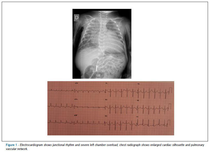 Case 3/2013: a newborn with aortic valve stenosis mimicking hypoplastic left heart