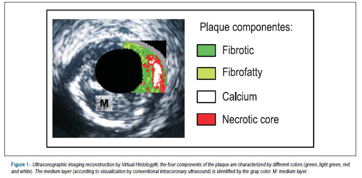 Correlation between plaque composition as assessed by virtual histology and C-reactive protein
