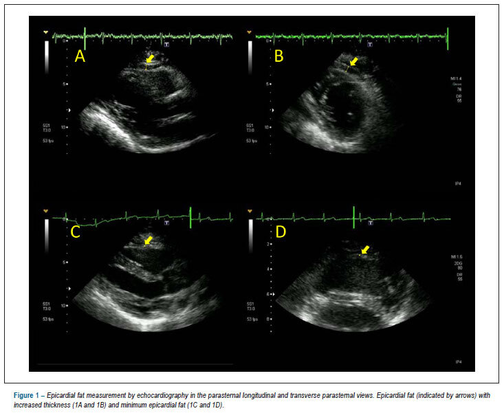 Epicardial fat: definition, measurements and systematic review of main outcomes