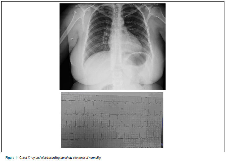 Case 4/2013: woman with transposition of the great arteries and delayed corrective progress