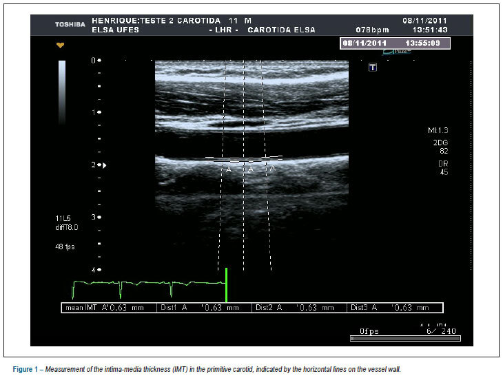 Correlation between the intima-media thickness of the proximal and distal common carotids