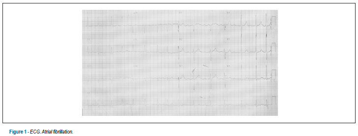 Case 4: 84-year old female with precordial pain and cardiac arrest with pulseless electrical activity