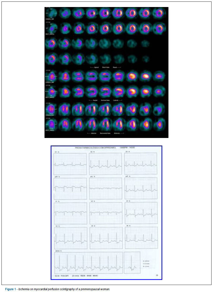 Prevalence of ischemia on myocardial perfusion scintigraphy of pre-and postmenopausal women
