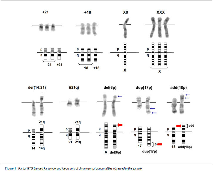 Chromosomal abnormalities in patients with congenital heart disease