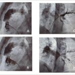 Figura 2