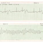 Figure 2A