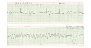 Figure 2A