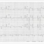 Figure 2B