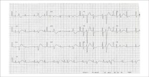 Figure 2B