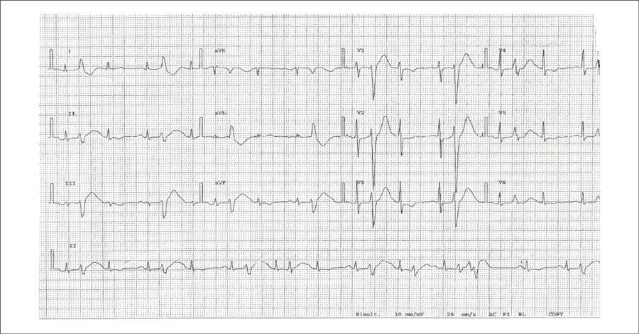 Figure 2B