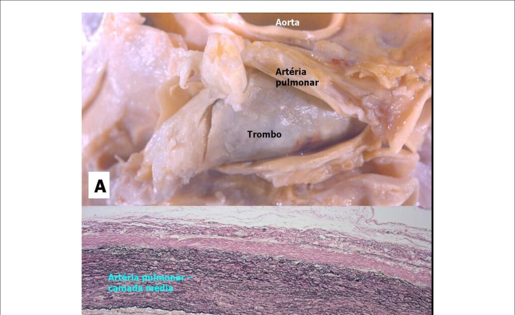 Figura 10