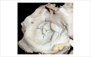 Figura 3
