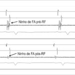 Figura 2