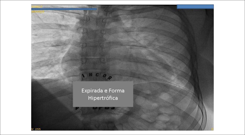 Figura 1