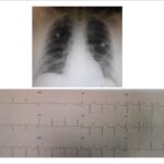 Figura 1