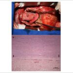 Figura 2