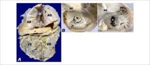 Figura 2