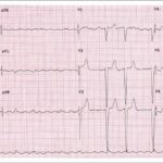 Figura 5