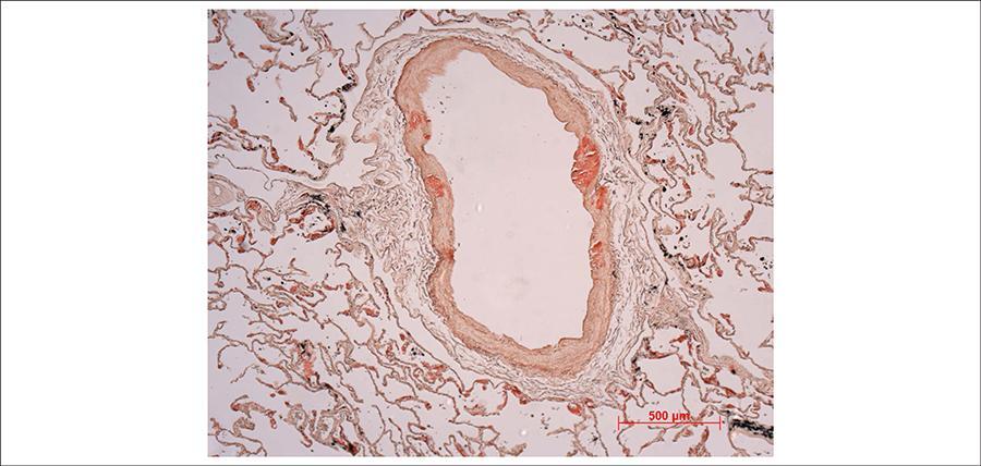 Figura 11