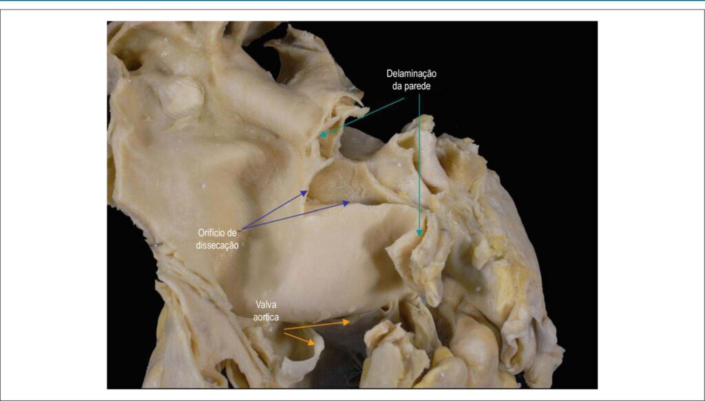 Figura 1