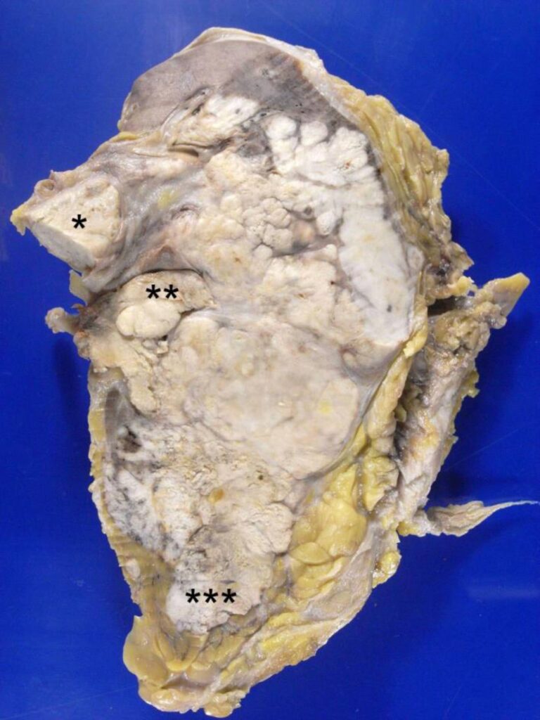 Figura 6
