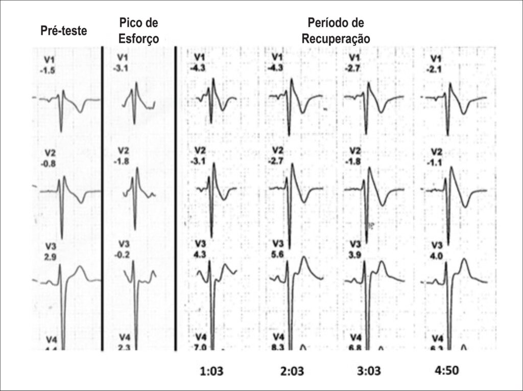 Figura 2