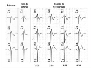 Figura 2