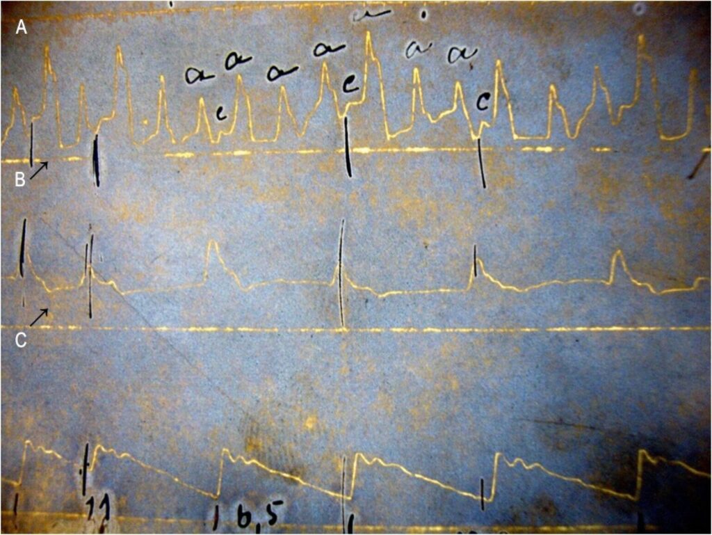 Figura 1