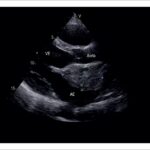 Figura 1