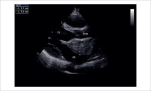 Figura 1