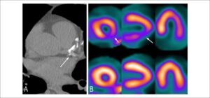 Figura 4