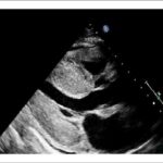 Figura 1
