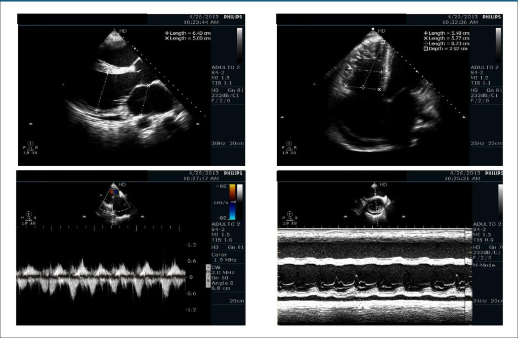 Figure 4