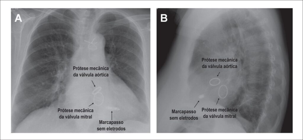 Figura 1