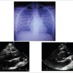 Figure1
